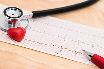 Electrophysiology test