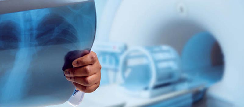 Doctor reviewing Xray