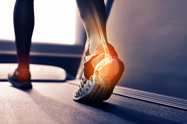 Treadmill foot pain