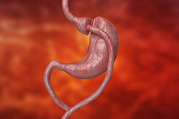 A 3d rendering of a human stomach