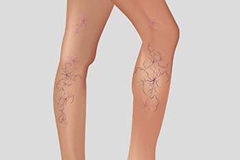 A cropped photo of a pair of legs